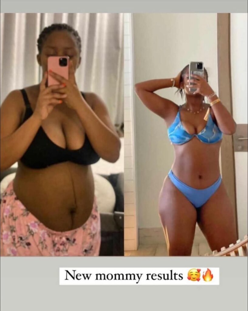 Amaka slimming transformation